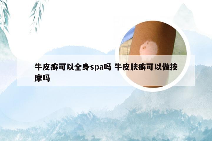 牛皮癣可以全身spa吗 牛皮肤癣可以做按摩吗