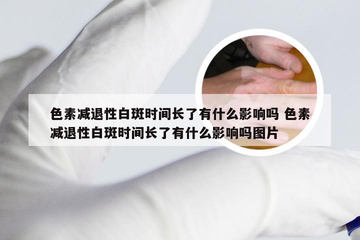 色素减退性白斑时间长了有什么影响吗 色素减退性白斑时间长了有什么影响吗图片