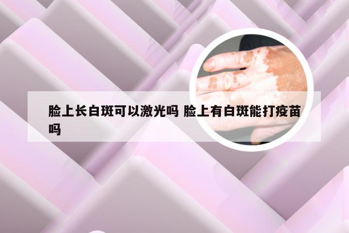 脸上长白斑可以激光吗 脸上有白斑能打疫苗吗