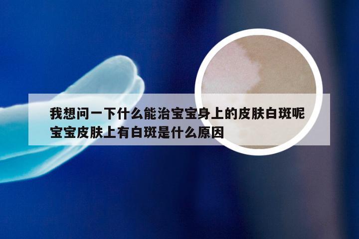 我想问一下什么能治宝宝身上的皮肤白斑呢 宝宝皮肤上有白斑是什么原因