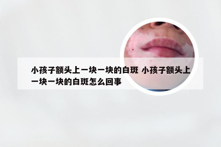 小孩子额头上一块一块的白斑 小孩子额头上一块一块的白斑怎么回事