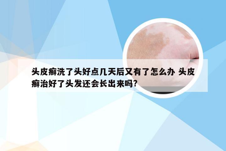 头皮癣洗了头好点几天后又有了怎么办 头皮癣治好了头发还会长出来吗?