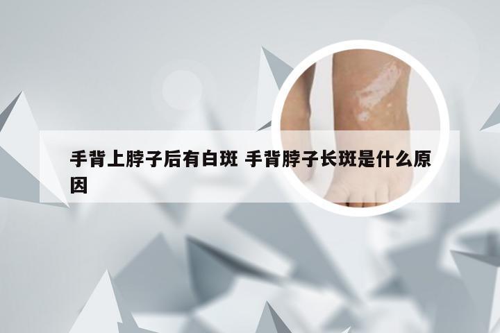 手背上脖子后有白斑 手背脖子长斑是什么原因