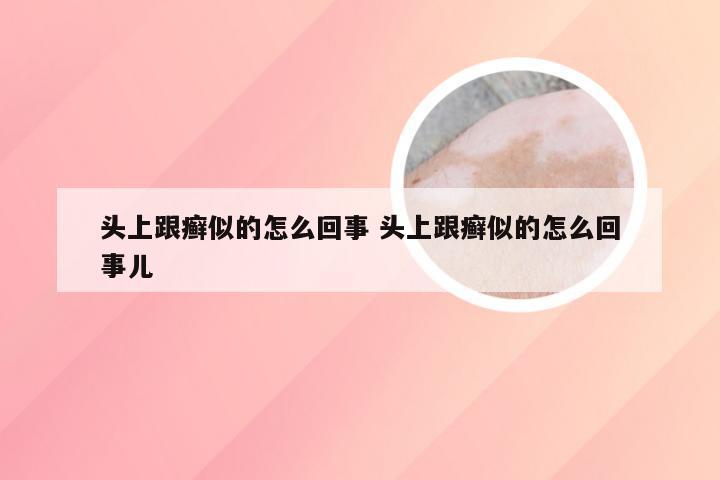 头上跟癣似的怎么回事 头上跟癣似的怎么回事儿