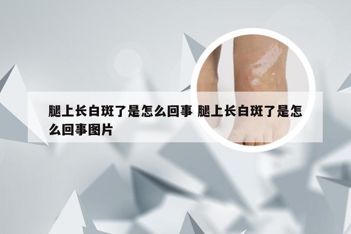 腿上长白斑了是怎么回事 腿上长白斑了是怎么回事图片