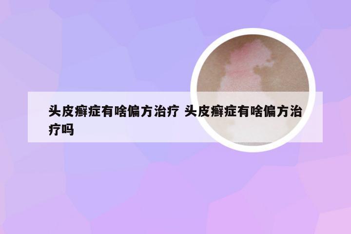 头皮癣症有啥偏方治疗 头皮癣症有啥偏方治疗吗