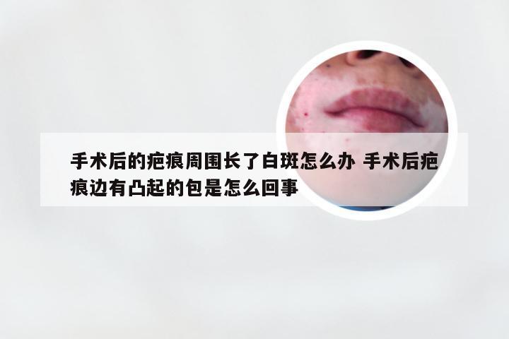 手术后的疤痕周围长了白斑怎么办 手术后疤痕边有凸起的包是怎么回事