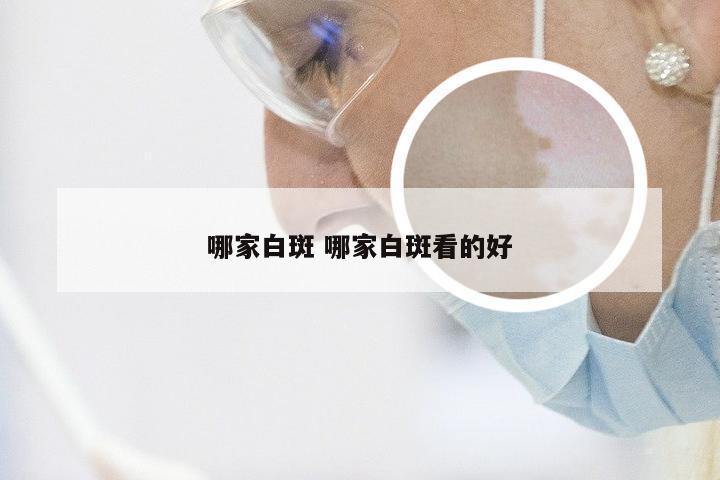 哪家白斑 哪家白斑看的好