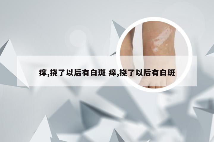 痒,挠了以后有白斑 痒,挠了以后有白斑