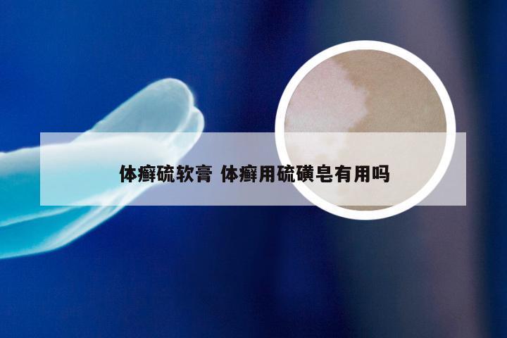 体癣硫软膏 体癣用硫磺皂有用吗