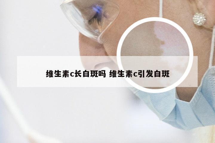 维生素c长白斑吗 维生素c引发白斑