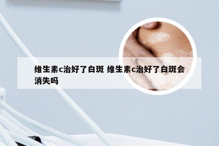 维生素c治好了白斑 维生素c治好了白斑会消失吗