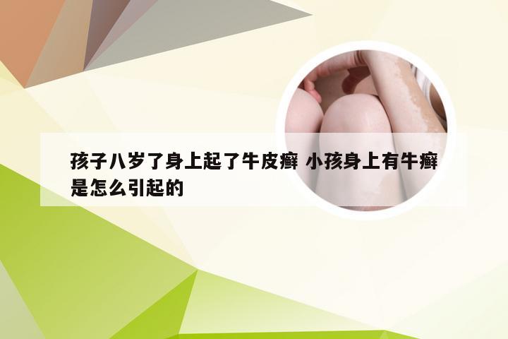 孩子八岁了身上起了牛皮癣 小孩身上有牛癣是怎么引起的