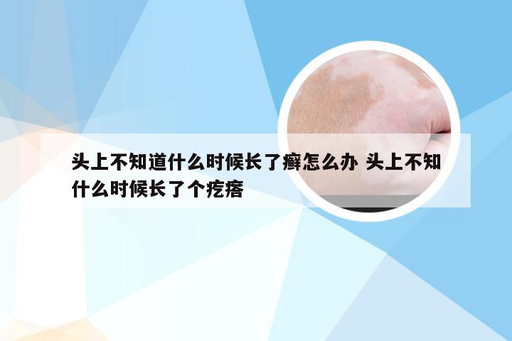 头上不知道什么时候长了癣怎么办 头上不知什么时候长了个疙瘩