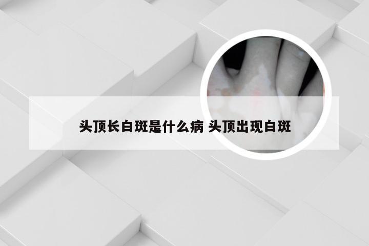 头顶长白斑是什么病 头顶出现白斑