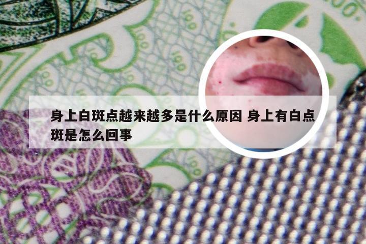 身上白斑点越来越多是什么原因 身上有白点斑是怎么回事