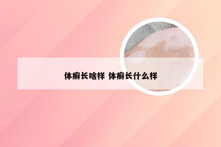 体癣长啥样 体癣长什么样