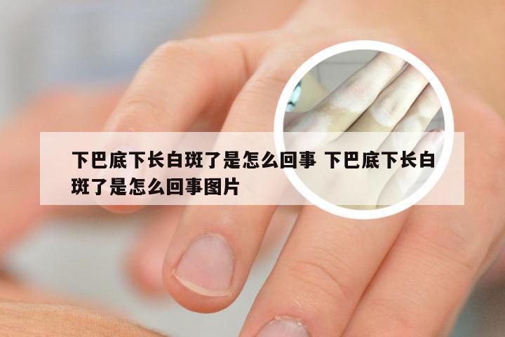 下巴底下长白斑了是怎么回事 下巴底下长白斑了是怎么回事图片