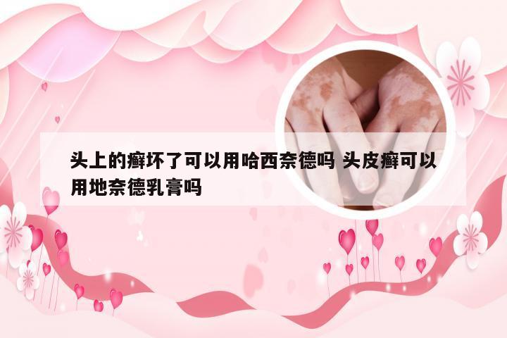 头上的癣坏了可以用哈西奈德吗 头皮癣可以用地奈德乳膏吗