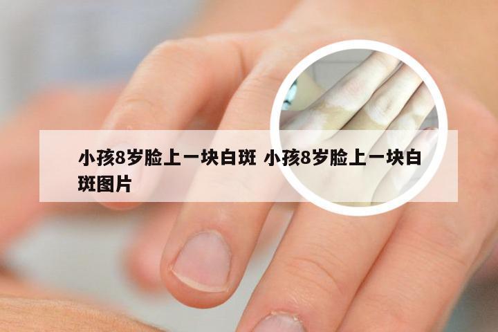 小孩8岁脸上一块白斑 小孩8岁脸上一块白斑图片