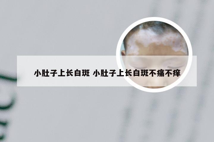 小肚子上长白斑 小肚子上长白斑不痛不痒