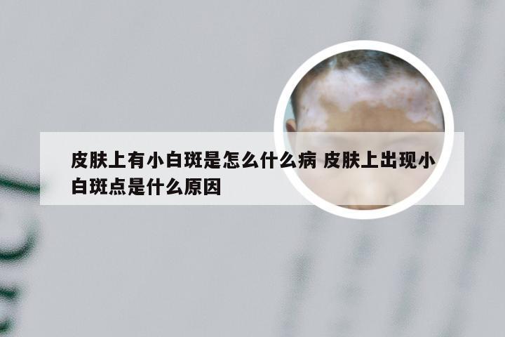 皮肤上有小白斑是怎么什么病 皮肤上出现小白斑点是什么原因