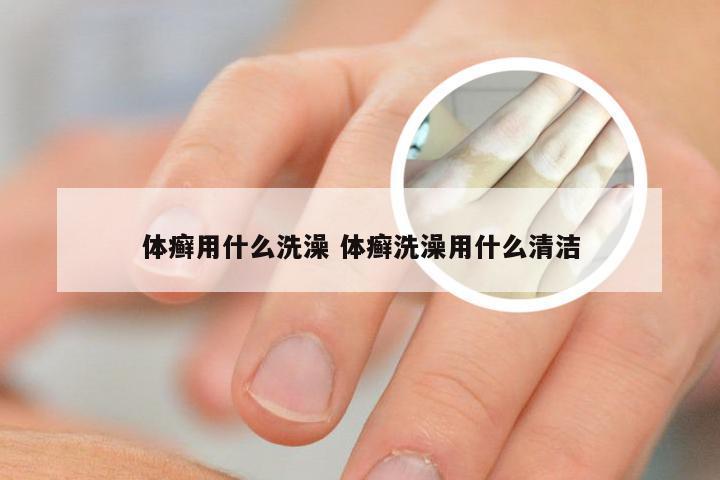 体癣用什么洗澡 体癣洗澡用什么清洁