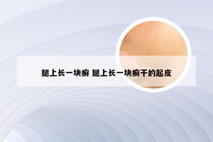 腿上长一块癣 腿上长一块癣干的起皮