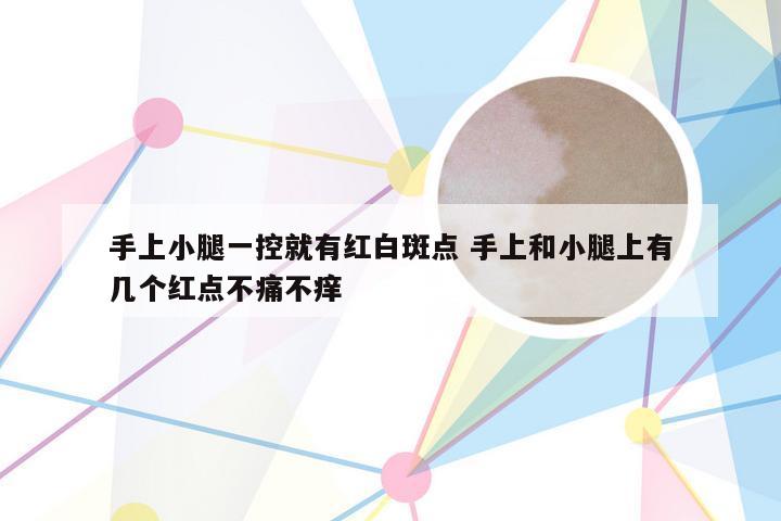 手上小腿一控就有红白斑点 手上和小腿上有几个红点不痛不痒