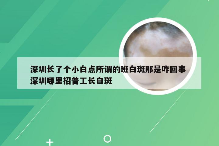 深圳长了个小白点所谓的班白斑那是咋回事 深圳哪里招普工长白斑