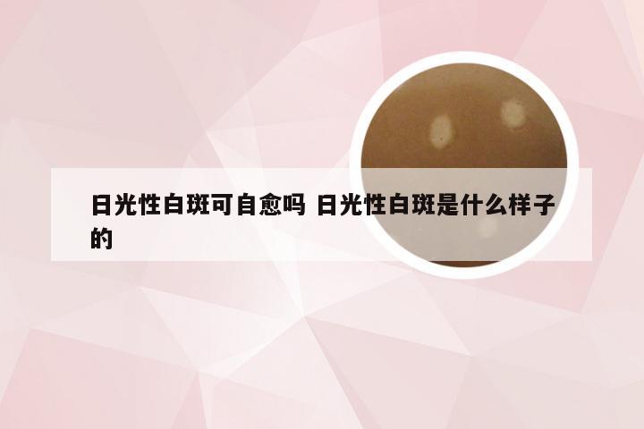 日光性白斑可自愈吗 日光性白斑是什么样子的