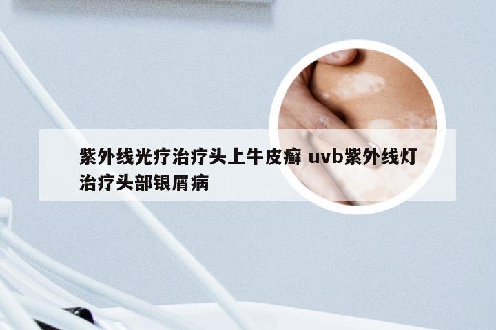 紫外线光疗治疗头上牛皮癣 uvb紫外线灯治疗头部银屑病