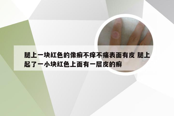 腿上一块红色的像癣不痒不痛表面有皮 腿上起了一小块红色上面有一层皮的癣