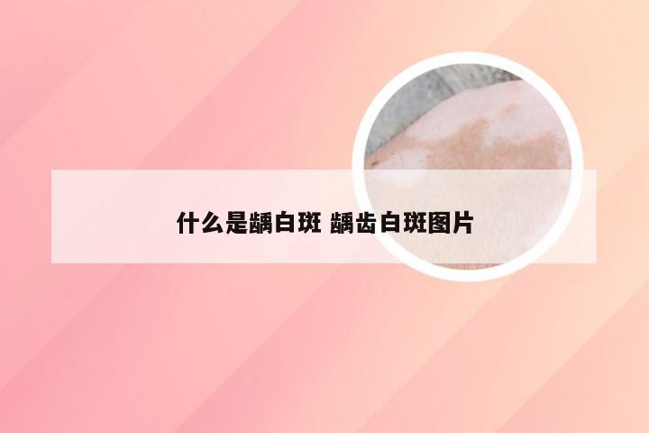 什么是龋白斑 龋齿白斑图片