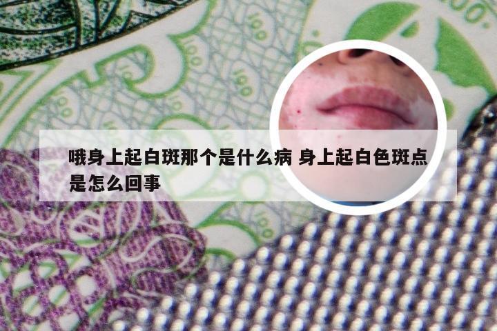 哦身上起白斑那个是什么病 身上起白色斑点是怎么回事