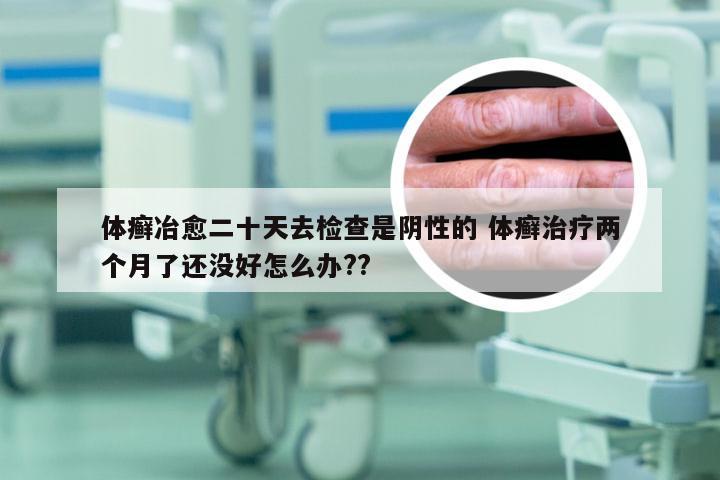 体癣冶愈二十天去检查是阴性的 体癣治疗两个月了还没好怎么办??