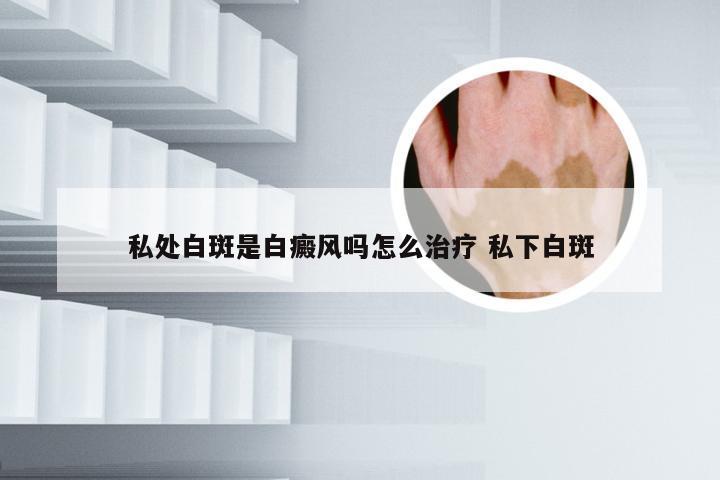 私处白斑是白癜风吗怎么治疗 私下白斑