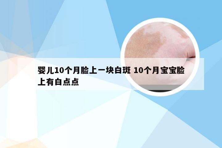 婴儿10个月脸上一块白斑 10个月宝宝脸上有白点点