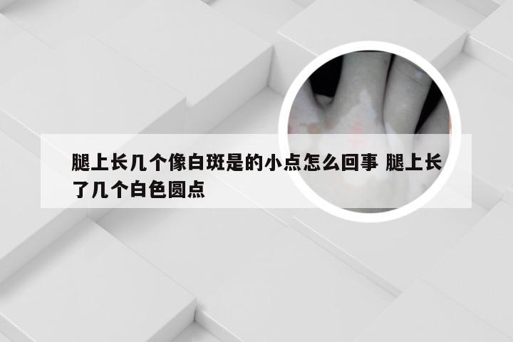 腿上长几个像白斑是的小点怎么回事 腿上长了几个白色圆点