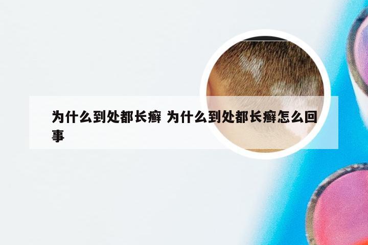 为什么到处都长癣 为什么到处都长癣怎么回事