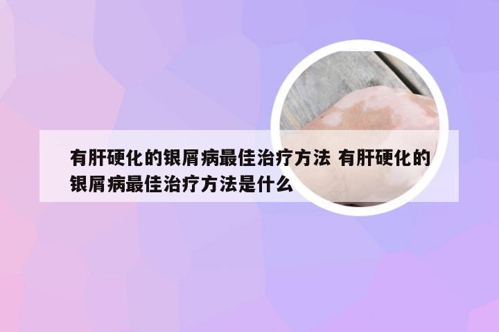 有肝硬化的银屑病最佳治疗方法 有肝硬化的银屑病最佳治疗方法是什么