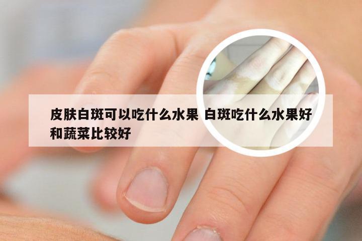 皮肤白斑可以吃什么水果 白斑吃什么水果好和蔬菜比较好