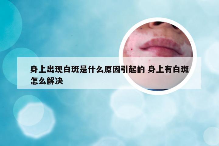 身上出现白斑是什么原因引起的 身上有白斑怎么解决