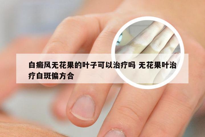 白癜风无花果的叶子可以治疗吗 无花果叶治疗白斑偏方合