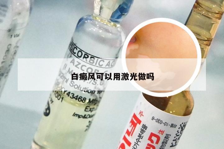 白癜风可以用激光做吗