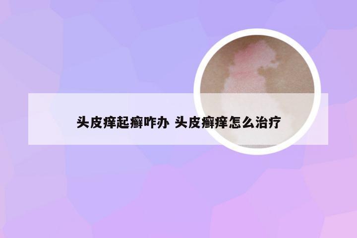 头皮痒起癣咋办 头皮癣痒怎么治疗