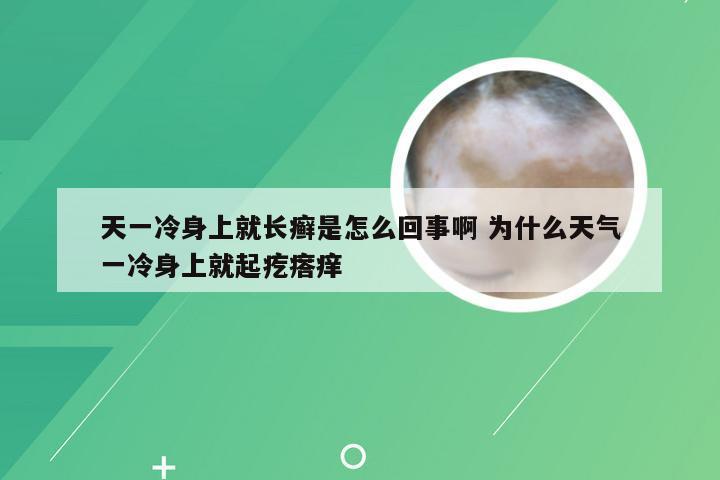 天一冷身上就长癣是怎么回事啊 为什么天气一冷身上就起疙瘩痒