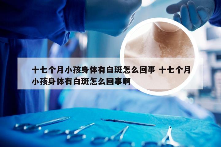 十七个月小孩身体有白斑怎么回事 十七个月小孩身体有白斑怎么回事啊