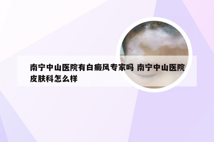 南宁中山医院有白癜风专家吗 南宁中山医院皮肤科怎么样