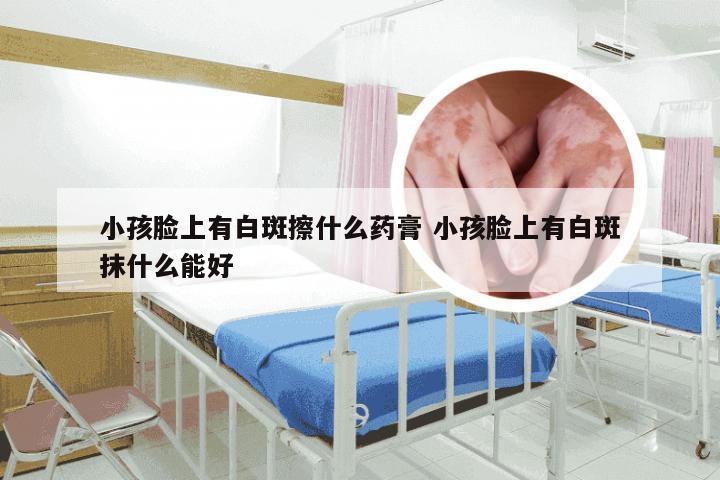 小孩脸上有白斑擦什么药膏 小孩脸上有白斑抹什么能好